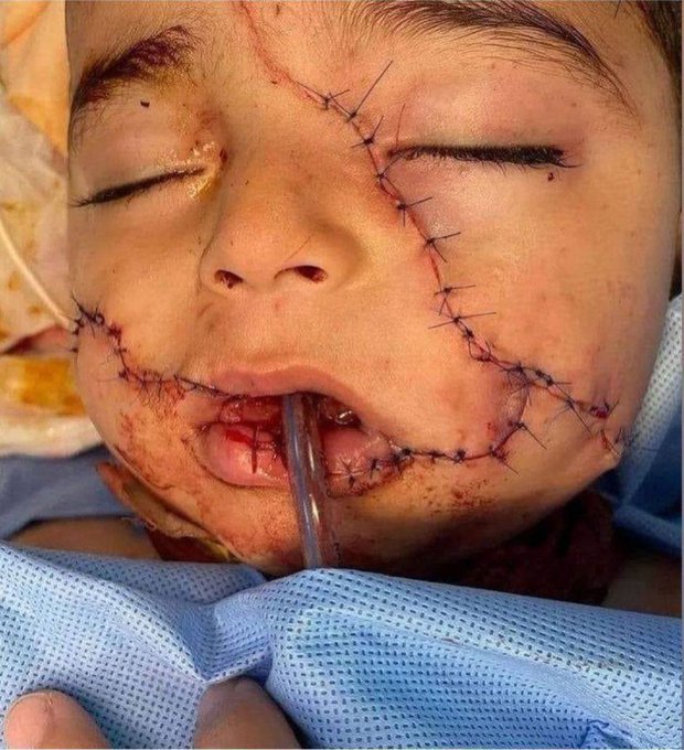 ‏أطفال ‎#غزة يا...