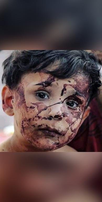معاناة طفل فلسطيني...