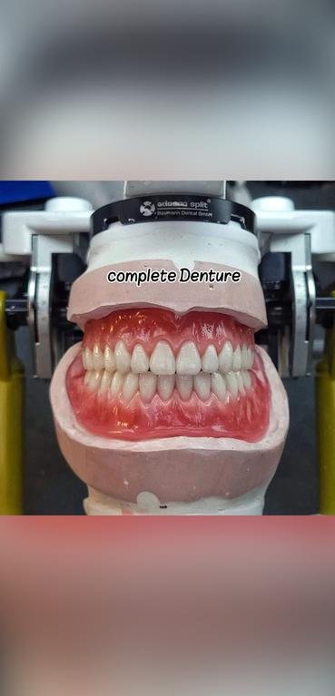 #complete Denture#dentistry...